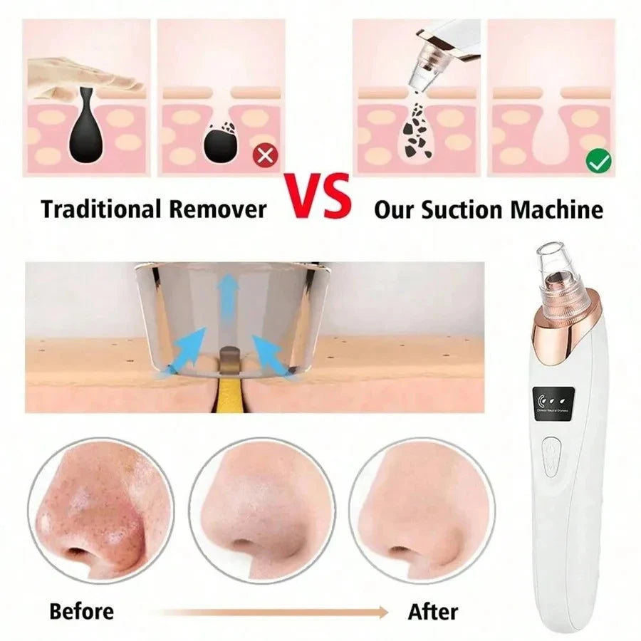 Electric Pore Vacuum Device - Professional Blackhead Remover & Deep Facial Cleanser Tool