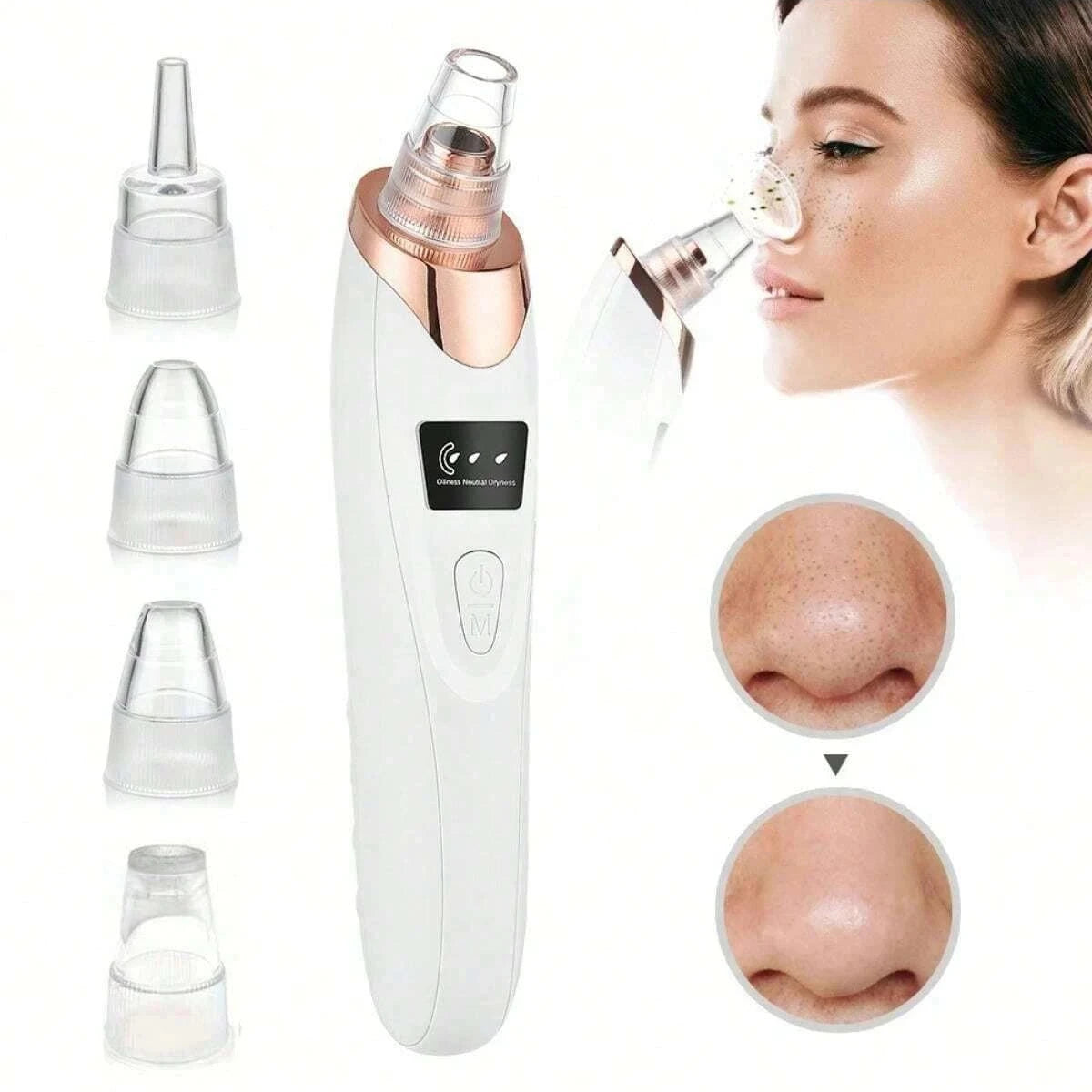 Electric Pore Vacuum Device - Professional Blackhead Remover & Deep Facial Cleanser Tool