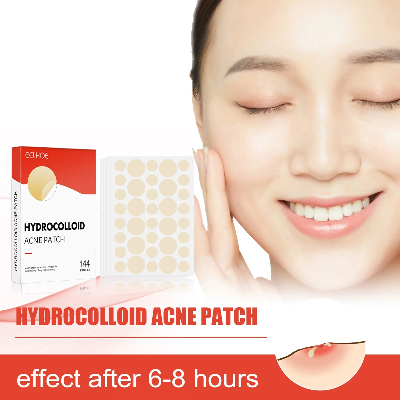 Hydrocolloid Acne Patches – Invisible, Breathable & Makeup-Friendly (2 Sizes)